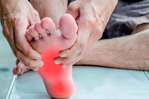 FASCIOSIS PLANTAR Ó FASCITIS PLANTAR: DOLOR EN LA PLANTA DEL PIE